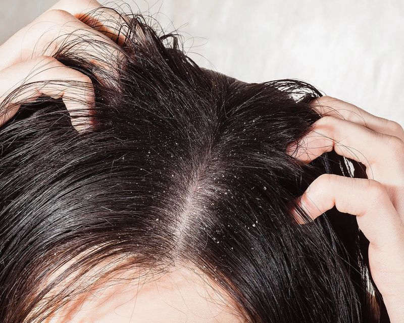 Try Scalp Exfoliation Treatments