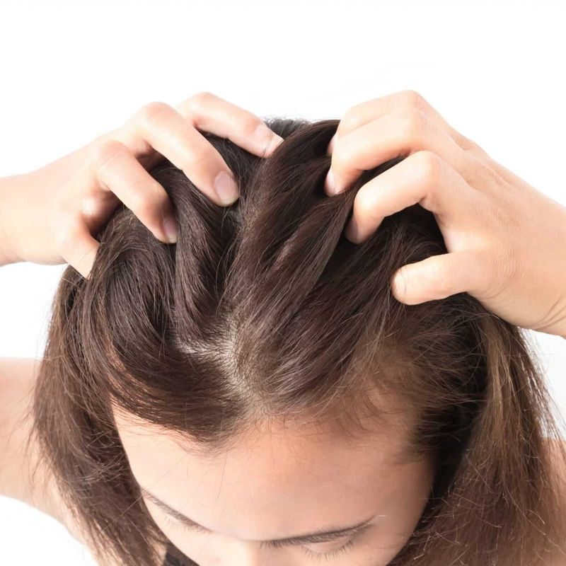 Scalp Becomes Sensitive