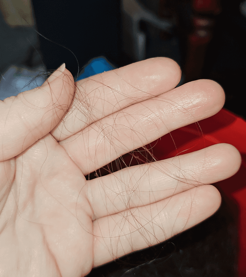 Identifying Coarse Hair Texture